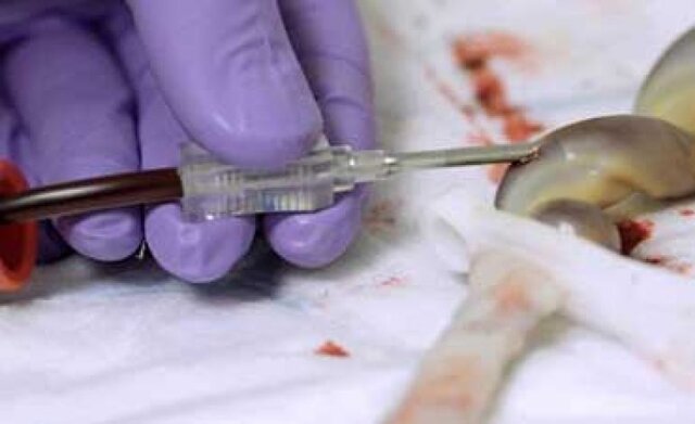 زباله بیولوژیک