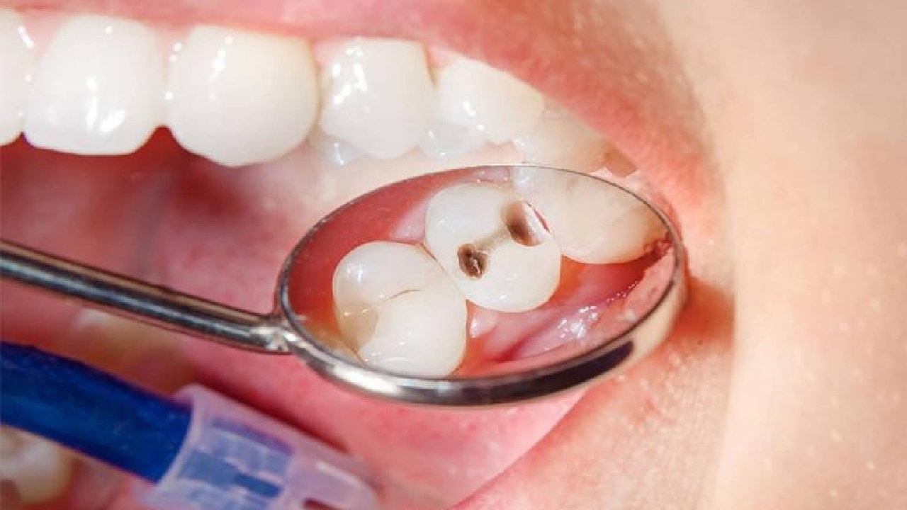 نکاتی ساده برای جلوگیری از افتادن دندان‌ها با افزایش سن