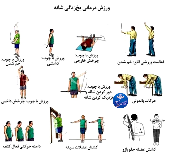 تشخیص و درمان شانه منجمد
