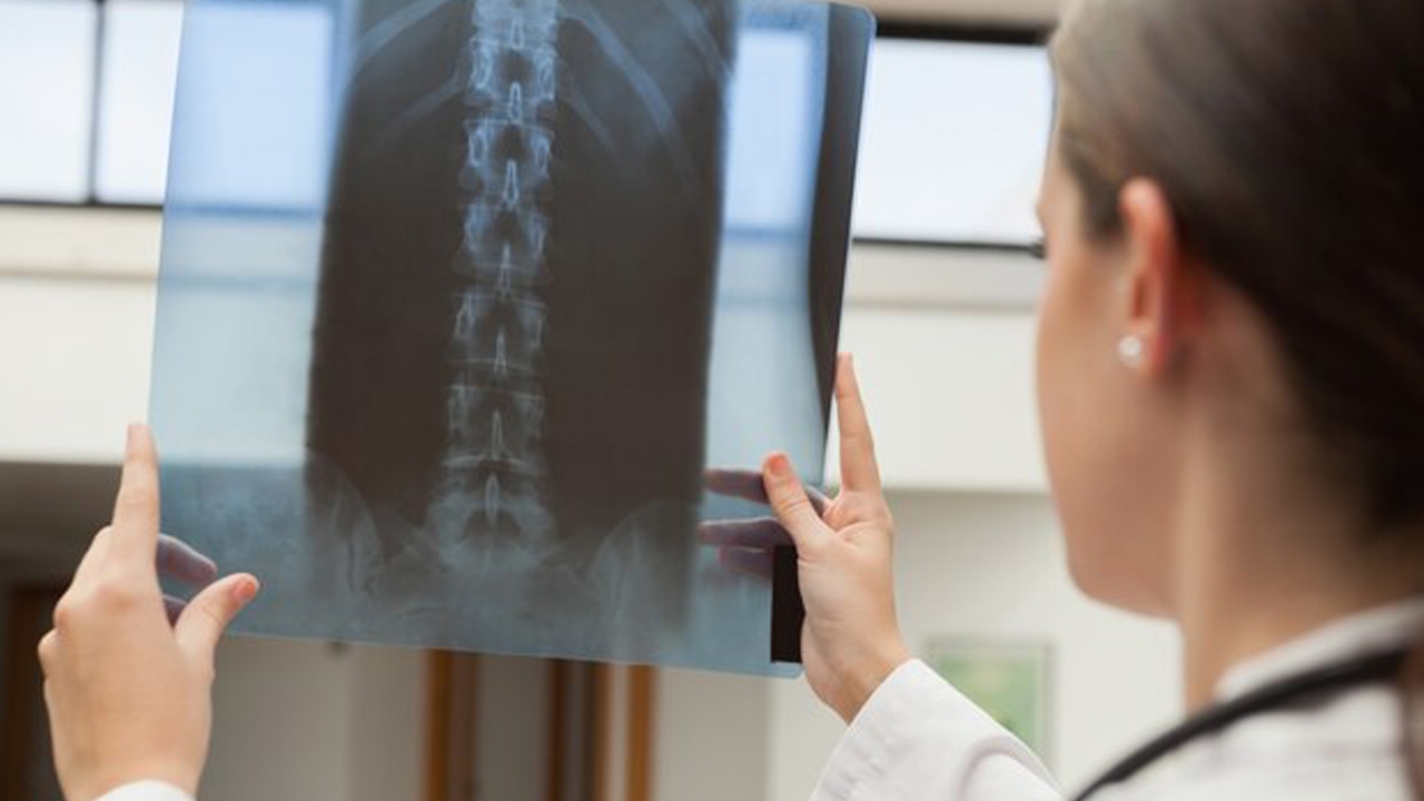 دستاورد نوین دانشمندان برای بازسازی و توقف تخریب دیسک بینمهرهای دستاورد نوین دانشمندان برای بازسازی و توقف تخریب دیسک بینمهرهای